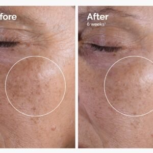 Tónico exfoliante con ácido glicólico al 7% de The Ordinary