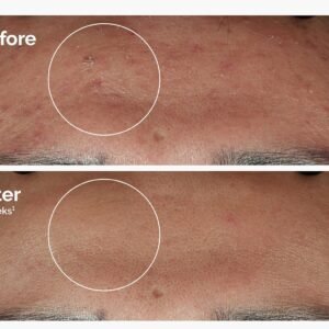 Sérum Niacinamida 10% + Zinc 1% de The Ordinary