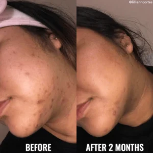 Sérum Discoloration Correcting de Good Molecules